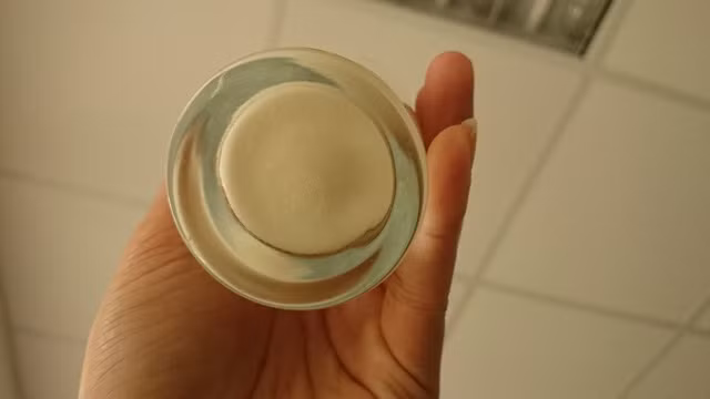 Hiện tượng sữa Anlene bị đóng cặn cứng, rắn ở đáy cốc khiến khách hàng lo lắng Hiện tượng sữa Anlene bị đóng cặn cứng, rắn ở đáy cốc khiến khách hàng lo lắng