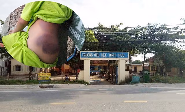 Có một kiểu "tra tấn" kinh dị trong trường học ảnh 2 Có một kiểu "tra tấn" kinh dị trong trường học ảnh 2