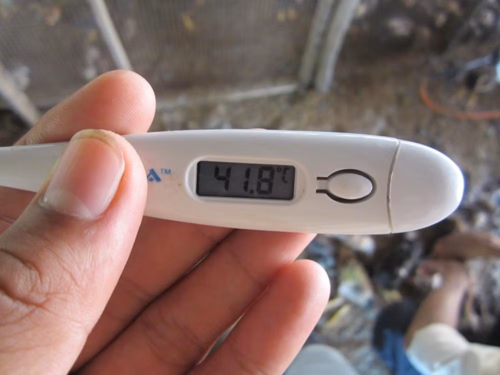 Trẻ em sốt cao có thể dẫn tới một cơn động kinh ảnh 2