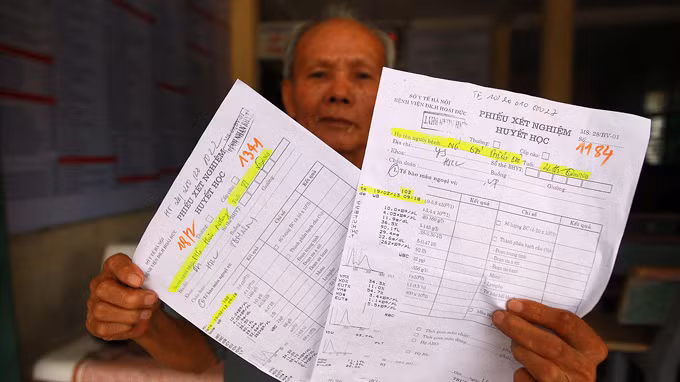 Phiếu xét nghiệm huyết học tại Bệnh viện Đa khoa Hoài Đức (Hà Nội) của hai người khác nhau nhưng các kết quả xét nghiệm lại hoàn toàn giống nhau - Ảnh tư liệu Phiếu xét nghiệm huyết học tại Bệnh viện Đa khoa Hoài Đức (Hà Nội) của hai người khác nhau nhưng các kết quả xét nghiệm lại hoàn toàn giống nhau - Ảnh tư liệu
