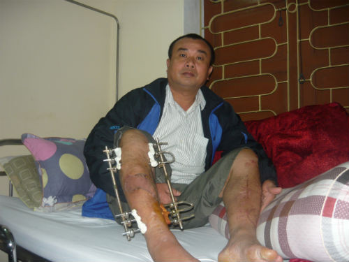 Chân dung vị CSGT hai lần bị "quái xế" tông gãy tay, chân.