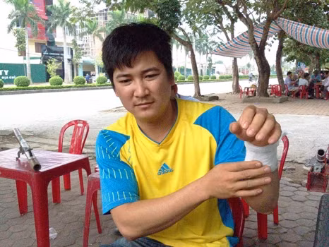 Anh Đặng Văn Chung cho biết, khi bỏ chạy nhóm người này đã xả súng vào ngôi nhà chị Hằng nên đạn lạc đã bắn trúng anh và nữ đồng nghiệp làm việc gần đó Anh Đặng Văn Chung cho biết, khi bỏ chạy nhóm người này đã xả súng vào ngôi nhà chị Hằng nên đạn lạc đã bắn trúng anh và nữ đồng nghiệp làm việc gần đó