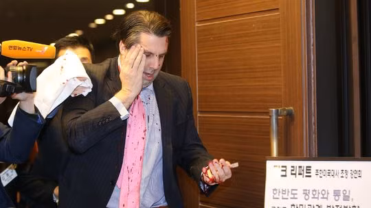 Đại sứ Mỹ tại Hàn Quốc Mark Lippert bị tấn công. Đại sứ Mỹ tại Hàn Quốc Mark Lippert bị tấn công.