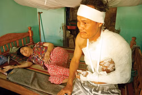 Ông Lê Trọng Kim bị người khai thác cát tấn công gây thương tích nặng, bên cạnh ông là người vợ bị bệnh nằm liệt giường. Ảnh: Gia Tân. Ông Lê Trọng Kim bị người khai thác cát tấn công gây thương tích nặng, bên cạnh ông là người vợ bị bệnh nằm liệt giường. Ảnh: Gia Tân.
