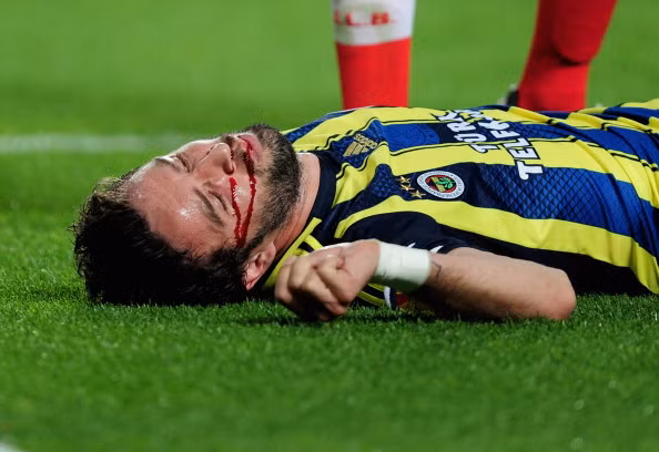 Tình huống diễn ra ở phút 57 trận bán kết lượt về Europa League giữa Benfica và Fenerbahce. Tình huống diễn ra ở phút 57 trận bán kết lượt về Europa League giữa Benfica và Fenerbahce.
