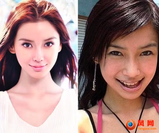 Siêu mẫu Angelababy, người tình của Huỳnh Hiểu Minh với hàm răng niềng "hấp dẫn". Siêu mẫu Angelababy, người tình của Huỳnh Hiểu Minh với hàm răng niềng "hấp dẫn".
