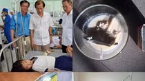 Từ những vụ ngộ độc, chất lượng sữa đưa vào trường học đang bị đặt câu hỏi lớn. Hình dưới (bên trái) là sản phẩm của Nutifood bị khách hàng "tố" kém chất lượng, vón cục. ảnh nguồn: Báo Hậu Giang, Sức khỏe Cộng đồng, VTV.