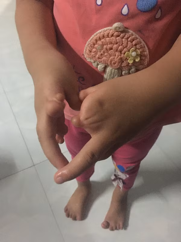 Hiện tại, bé Phước An vẫn có thể cầm bút viết, cầm màu tô dù khó khăn. (Ảnh: Phan Tuyết) Hiện tại, bé Phước An vẫn có thể cầm bút viết, cầm màu tô dù khó khăn. (Ảnh: Phan Tuyết)