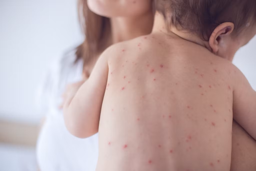Cảnh báo trẻ bị bỏng nước sôi lúc giao mùa ảnh 2
