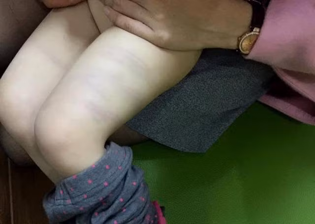 "Tự thú" của một cô giáo mầm non! ảnh 5 "Tự thú" của một cô giáo mầm non! ảnh 5