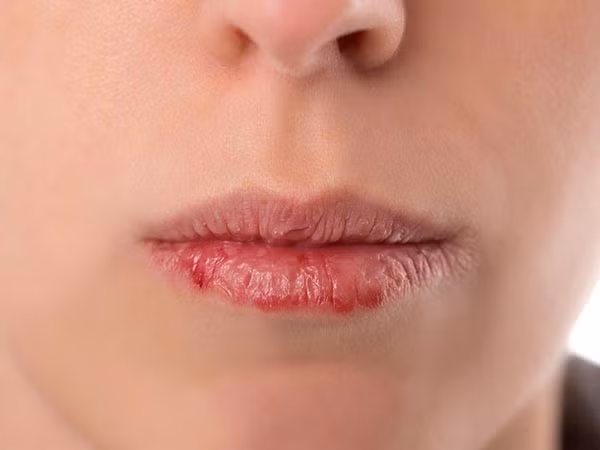 Lời khuyên về cách chăm sóc đôi môi của bạn ảnh 2