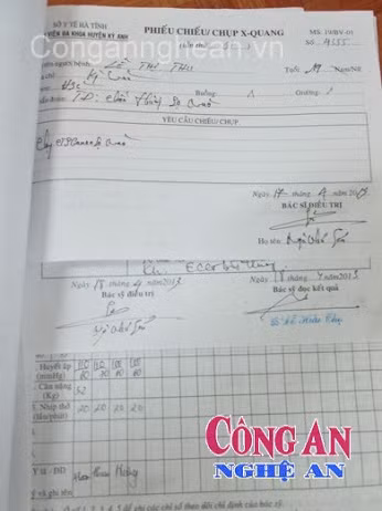 Chẩn đoán nạn nhân bị chấn thương sọ não của BVĐK Kỳ Anh. Ảnh: Công an Nghệ An