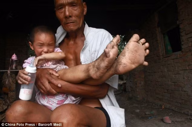 Bàn chân to quá khổ khiến Ngọc không thể mang giầy hay dép. Bàn chân to quá khổ khiến Ngọc không thể mang giầy hay dép.