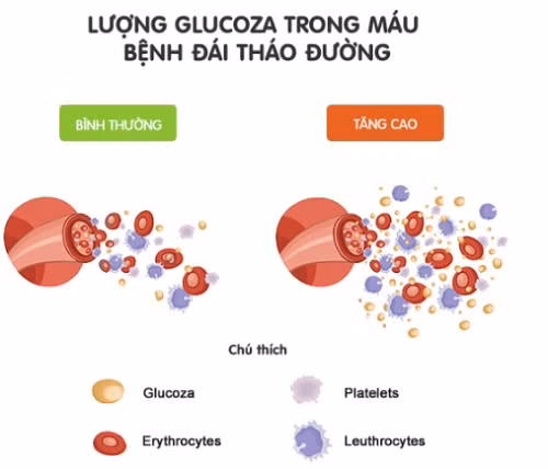 Đái tháo đường có thể dẫn đến mù lòa ảnh 2