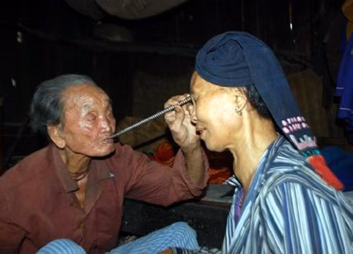 Đến nhà thầy, Tôi phải tự tay mổ, luộc gà, xếp đũa bát, bỏ thêm chai rượu làm mâm đồ cúng. Ông lấy hương đốt huơ quanh người tôi rồi vén áo lên, lấy ống hút dí vào sườn trái. Trước khi hút bệnh, ông uống một chén nước cho mồm miệng sạch, lau ống hút, lấy cả lông gà không cho bất kỳ một dị vật nào ở trong. Lúc hút tôi có cảm giác như bị ai véo vào da thịt, giật một cái, sau đó nhẹ nhõm, mát người lắm! Ông hút ra được một viên đá bằng hạt đỗ, màu trắng, bỏ vào cái bát rồi nhổ một bãi nước bọt. Hòn đá ấy lại được bỏ vào bếp than đang rực lửa. Kỳ lạ là đã ba năm nay tôi không bị đau lưng và đau đại tràng nữa”. Ông Bùi Ngọc Thích, Chủ tịch Mặt trận Tổ quốc xã Đồng Nghê (Đà Bắc, Hòa Bình), vốn bị thoái hóa 1 đốt sống lưng, đau đại tràng mãn tính kể lại.
