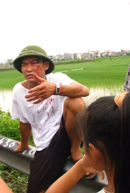 1. Đoàn "hộ tống" nhà sư "đi một bước, lạy một lạy" đánh người vỡ đầu Sáng 17/8, Đại đức Thích Tâm Mẫn đã về tới địa phận huyện Tiên Du, Bắc Ninh trong hành trình “nhất bộ nhất bái”. Dù gặp mưa khá lớn trên đường, trang phục ướt sũng nước nhưng Đại đức Thích Tâm Mẫn vẫn không hề ngưng bước. Nhưng điều khiến nhiều người bất bình và khó hiểu là nhóm người mặt mũi bặm trợn đi bên cạnh nhà sư này sẵn sàng dùng dùi cui và nắm đấm để ngăn không cho người dân gần vị sư. Anh Nguyễn Văn Cường (trú tại xã Liên Mão, Tiên Du) đã bị các đối tượng này đánh chảy máu đầu. (xem trọn bộ ảnh)