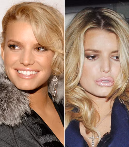 Cái bĩu môi không tự nhiên của Jessica Simpson. Cái bĩu môi không tự nhiên của Jessica Simpson.