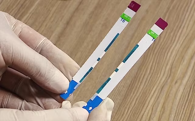 Vụ việc cắt đôi que thử nghiệm từng bị phát hiện tại bệnh viện Xanh pôn. Vụ việc cắt đôi que thử nghiệm từng bị phát hiện tại bệnh viện Xanh pôn.